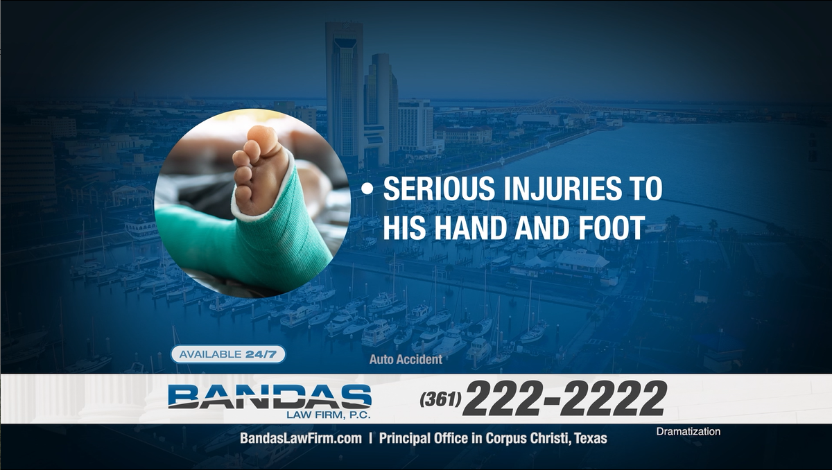 Auto accident causing serious injury to hand and foot
